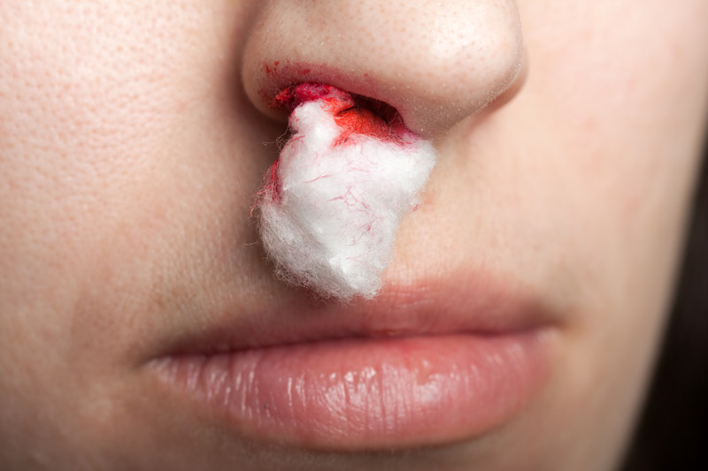 canstockphoto3548035