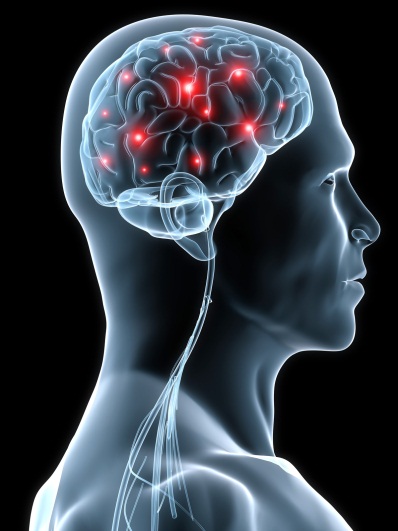 epilepsy
